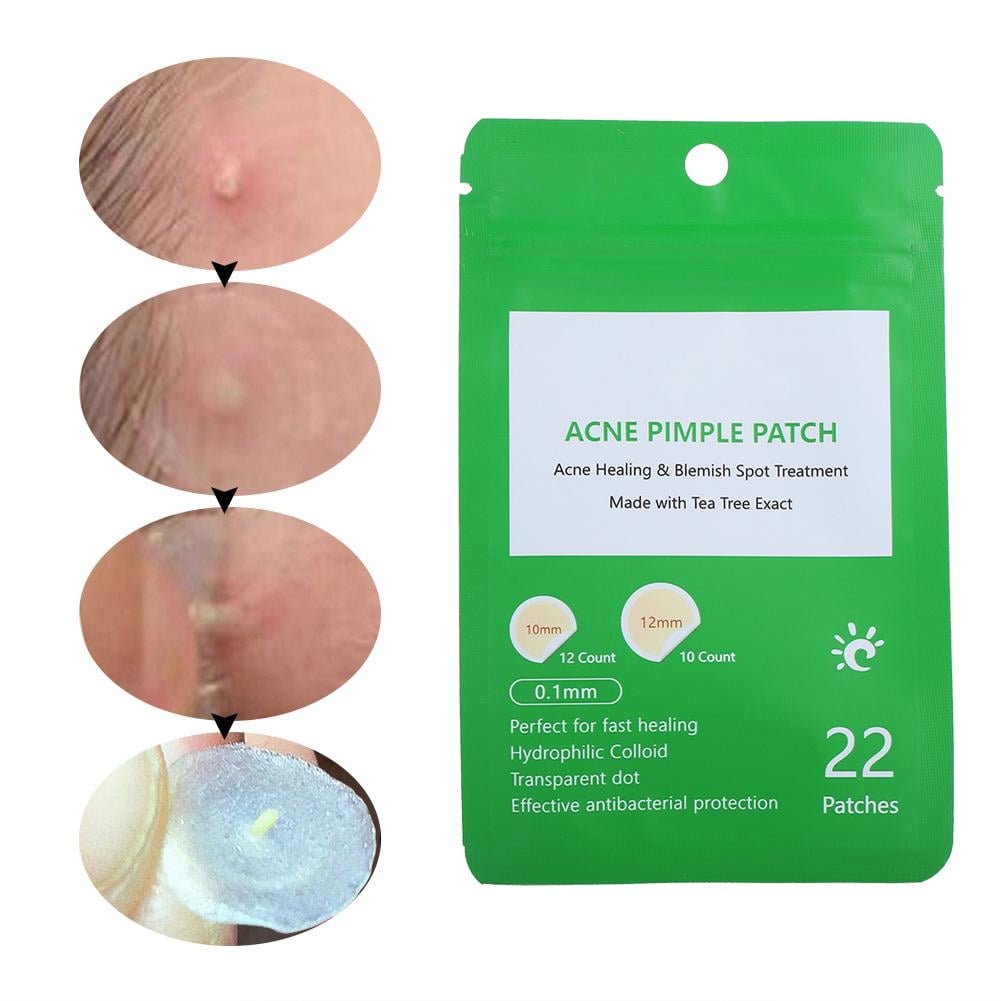 Mgaxyff Pimple Patch, Tea Tree Acne Pimple Patch Spot Scar Removal
