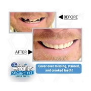 Instant Smile Secure Fit Upper Teeth Veneer- Temporary Aesthetic Smile Accessory (Non-Medical, Removable)