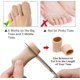thumbnail image 4 of Paquete de 10 protectores de funda de tela con superficie cerrada para los dedos del pie con forro de gel, previenen el alivio del dolor de callos, ampollas y uñas encarnadas (tamaño grande), 4 of 4