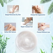 OUKEYA Urea Cream 40% Exfoliating Moisturizer, Hydration, 4 Pack