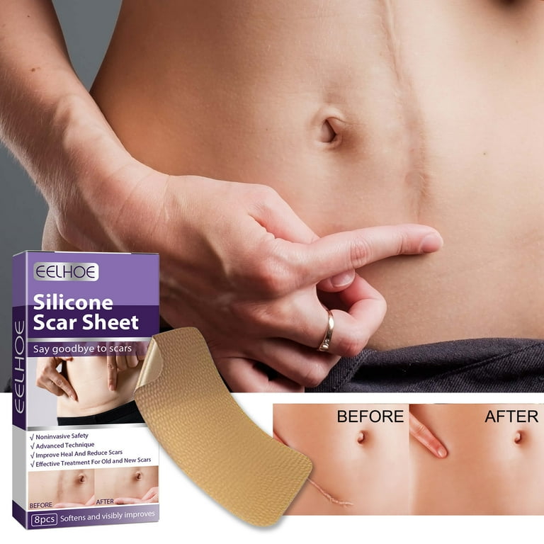 Medical Silicone Scar Sheets Silicone Gel Sheets for Scar Removal
