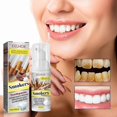 thumbnail image 2 of Remove Smoke Stains Toothpaste Smoke Stains Remove Teeth Stains Remove Yellow Clean Teeth Bright White Fresh Oral Care Toothpaste, 2 of 5
