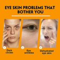 thumbnail image 3 of Turmeric Retinol Eye Cream Pen, Moisturising Eye Cream, Anti-ageing Eye Cream Against Dark Circles, Puffy Bags, 3 of 5