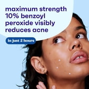 Clean & Clear Persa-Gel 10 Acne Treatment, Benzoyl Peroxide, 1 fl. oz