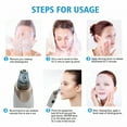 thumbnail image 2 of XIRQI Blackhead Remover Vacuum - Strong Suction Rechargeable Lightweight Pore Cleanser Acne Comedone Zit Pimple Extractor Sucker Tool for Women Men, White, 2 of 7