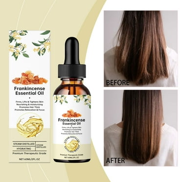 HYLLai Pure Frankincense Essential Oil - Deep Skin Nourishment, Anti-Aging & Aromatherapy Relaxation, 60ml