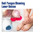 thumbnail image 2 of Nail Fungus Laser Treatment Device, 2 of 5