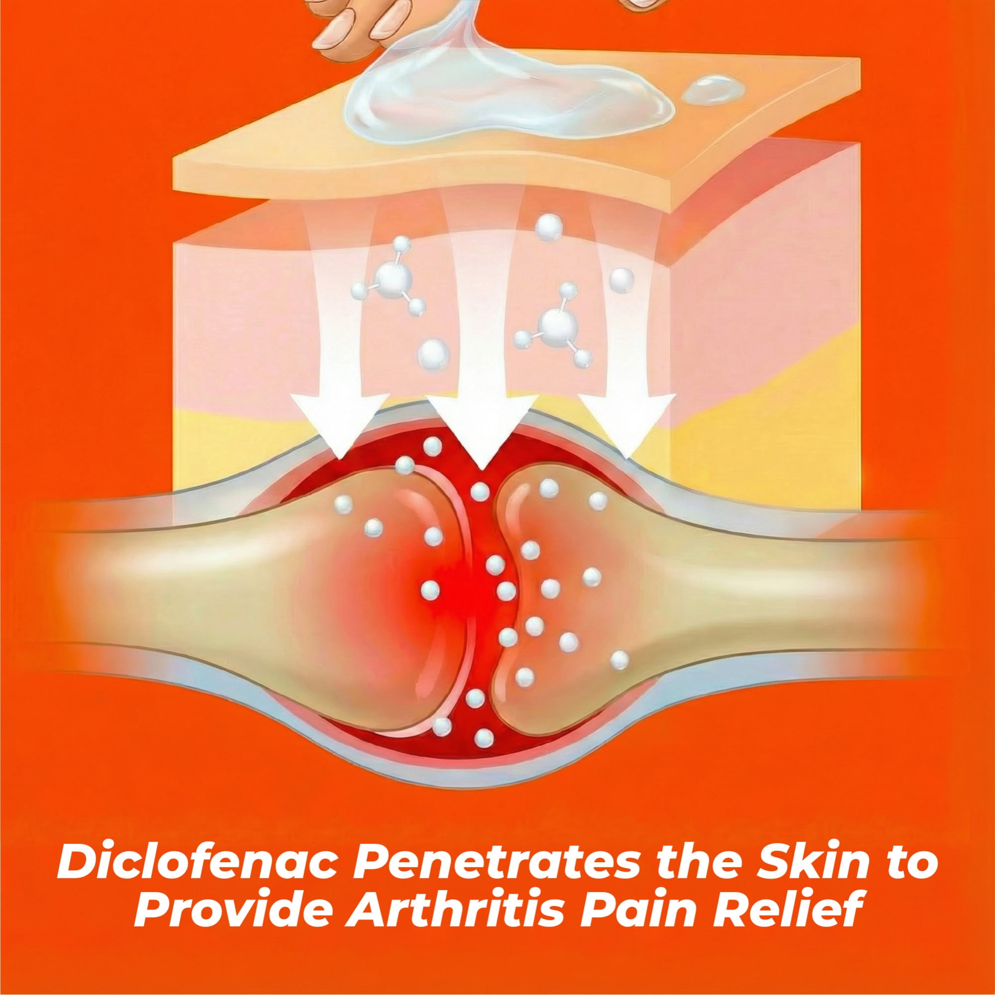 (4 pack) Aspercreme Arthritis Pain Relief Gel for Arthritis & Joint Pain, Non-steroidal Anti-inflammatory Topical Gel With Max-Strength Diclofenac Sodium, 100 g