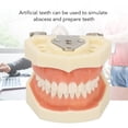 thumbnail image 4 of Modelo Dental De Quiste Maxilar, Marco De Mandíbula FE, Modelo De Preparación De Dientes, Resina, 28 Dientes, Encías Suaves Para Practicar Abscesos De Incisión, 4 of 7