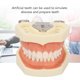 thumbnail image 4 of Modelo dental de quiste ANGGREK 28 Dientes fijación de Tornillos encías Blandas, 4 of 7