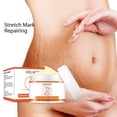 thumbnail image 2 of Loción corporal y crema de masaje para estrías HUOGUO que atenúa las líneas finas, 2 of 5