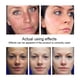 thumbnail image 3 of Crema Blanqueadora Para Aliviar El Melasma Y Las Manchas Oscuras, 3 of 4