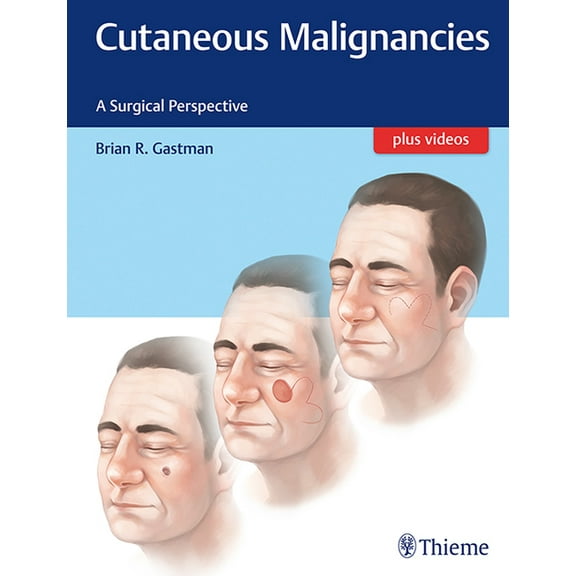 Cutaneous Malignancies: A Surgical Perspective (Hardcover)