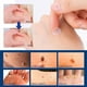 thumbnail image 1 of Parche para eliminar verrugas para todo tipo de piel Elimina lunares, callos y verrugas planas del cuello Parche para eliminar verrugas faciales, 1 of 9