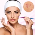 thumbnail image 3 of 7PCS Acne Tool Kit Steel Blackhead Tweezers Kit Comedone Extractor Kit with Case, 3 of 10