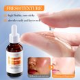 thumbnail image 1 of Xihbxyly Ofertas relámpago de hoy Prime Tratamientos y curas recomendados para nocturnos opacidos y amarilles y melanina reducida 30 ml, 1 of 7