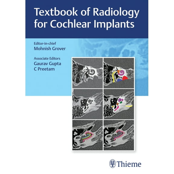 Textbook of Radiology for Cochlear Implants, (Hardcover)