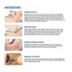 thumbnail image 4 of Mini Plasma Pen Remove Pen Wart Remover Mole Remover Use Ces, 4 of 4