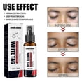 thumbnail image 5 of Vitiligo Removal Spray Moisturize Improve Pigmentation Leukoplakia Anti Melanin Remove Ringworm Lamp White Spots Treatment Spray, 5 of 5
