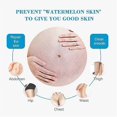 thumbnail image 2 of 2x Removes Stretch Mark Cream Pregnant Women Repair Anti-aging Anti-winkles Cream Increase Skin Elasticity Smooth Firm Skin Care, 2 of 5