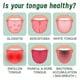 thumbnail image 3 of EELHOE Tongue Repair Spray Repairs white tongue coating and relieves tongue cracking and swelling oral care spray, 3 of 5