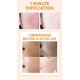 thumbnail image 3 of Crema Exfoliante Corporal Ganfancp Gel Exfoliante Facial Limpieza de Cutis 60Ml, 3 of 7
