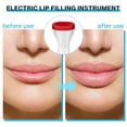 thumbnail image 3 of Plumper de labios, herramienta para rellenar labios, herramienta para rellenar labios eléctrica para mujeres, herramienta para mejorar los labios (blanco), 3 of 5