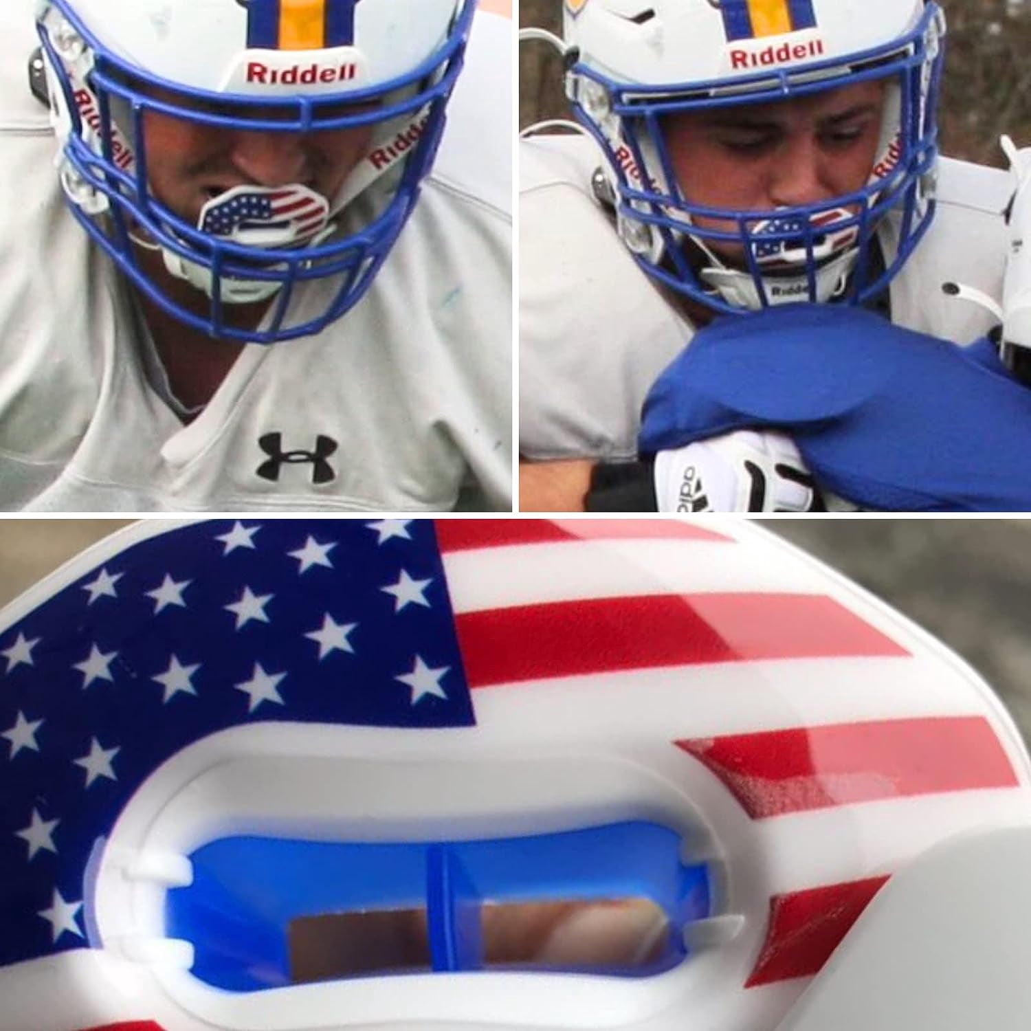 Flag Football Mouth Guard with 3D LipFit Design for Kids - Youth Tackle Football Mouthguard (No Boil) Cool Instant Fit Lip Guard Mouthpiece for Braces (Detachable Helmet Strap Included)