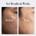 thumbnail image 4 of Crema facial hidratante Geologie Skin Repair Clear System 60 ml, 4 of 9
