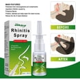thumbnail image 2 of Aerosol nasal Congestión nasal, picazón, goteo nasal, estornudos, cuidado nasal, solución para el cuidado de la nariz Aerosol nasal para alergias, alivio de alergias, antihistamínico sin esteroides, 2 kaili Sencillez, 2 of 5