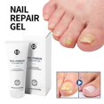 thumbnail image 2 of Healio Nail Treatment Gel ,foot Care Gel Anti Infection Thicken Soft Nails, 2 of 5