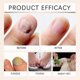 thumbnail image 4 of 3X Bee Venom Nail Repair Serum, Nail Care Solution, Natural Bee Venom Nail Care Spray, Ingrown Toenail Care Spray, 4 of 5