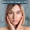 thumbnail image 4 of Silicone Face Scrubber for Men & Women | Soft Face Wash Brush (Pack of 1), 4 of 6