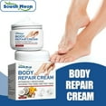 Kehuo Urea Foot Cream,Urea Cream for Feet,Urea Foot Cream 40 Percent