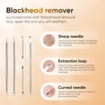 thumbnail image 3 of Aspirador de puntos negros - Extractor profesional de puntos negros para rostro con 3 niveles de succión ajustables, limpiador de poros recargable por USB y 5 sondas intercambiables (blanco), 3 of 4