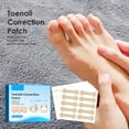 thumbnail image 3 of Pegatinas correctoras de uñas encarnadas, parche Corrector de uñas, herramienta de corrección de uñas, parche Corrector de uñas, herramientas de pedicura, 3 of 8