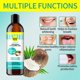 thumbnail image 5 of Coconut Oil Pulling With Tongue Scraper, Whitening Pulling Oil Mouthwash, Peppermint Essential Oil For Fresh Breath, Teeth Whitening, 5 of 5