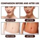 thumbnail image 4 of Tanning Gel, Brown Tanning Gel,soft Brown Intensive Tanning Luxe Gel,sunless Tanner,eelhoe Tanning Accelerator Cream For Sunbeds & Outdoor Sun,self Ta, 4 of 5