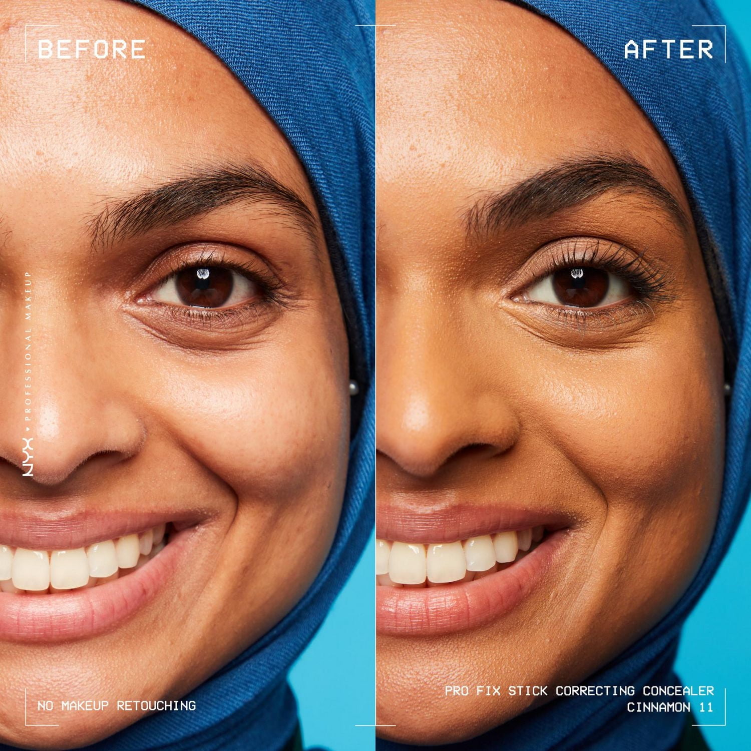 NYX PROFESSIONAL MAKEUP, Pro Fix Stick Correcting Concealer, Infused with hyaluronic acid, Cream formula