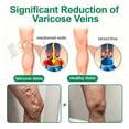 thumbnail image 2 of QARUN 2026 New Leg Varicose Veins Patch,Vein Target Microdarts Patch,Vein Target Patch,Natural Ingredients Leg Treatment for All Skin Types (3Boxes), 2 of 5