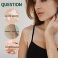 thumbnail image 3 of 30g White Spots Treatments Cream Improve Skin Pigmentation Cream for Body Skin Repair, 3 of 5