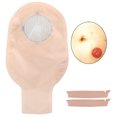 thumbnail image 2 of Bolsa de ostomía desechable, Bolsa de colostomía desechable de 10 Piezas Bolsa de Bolsa de ostomía Suave para la Piel Tipo Abierto Saludable Fugacal NO, 2 of 7
