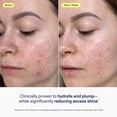 thumbnail image 3 of Crema hidratante en gel restauradora Skinfix Skin Barrier 50 ml, 3 of 9