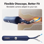 Bebird Max 22 Ear Wax Remover