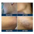 thumbnail image 3 of DepilatoriesEast Moon Prevent Hair Inner Length Essence Gentle Moisturizing Beard Care Repair Body Hair Inner Length - 30Ml, 3 of 5