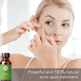 thumbnail image 2 of Tea Tree Essential Oil - Face, Hair, and Diffuser - Therapeutic Grade, 1 fl oz by Pure Body Naturals, 2 of 6