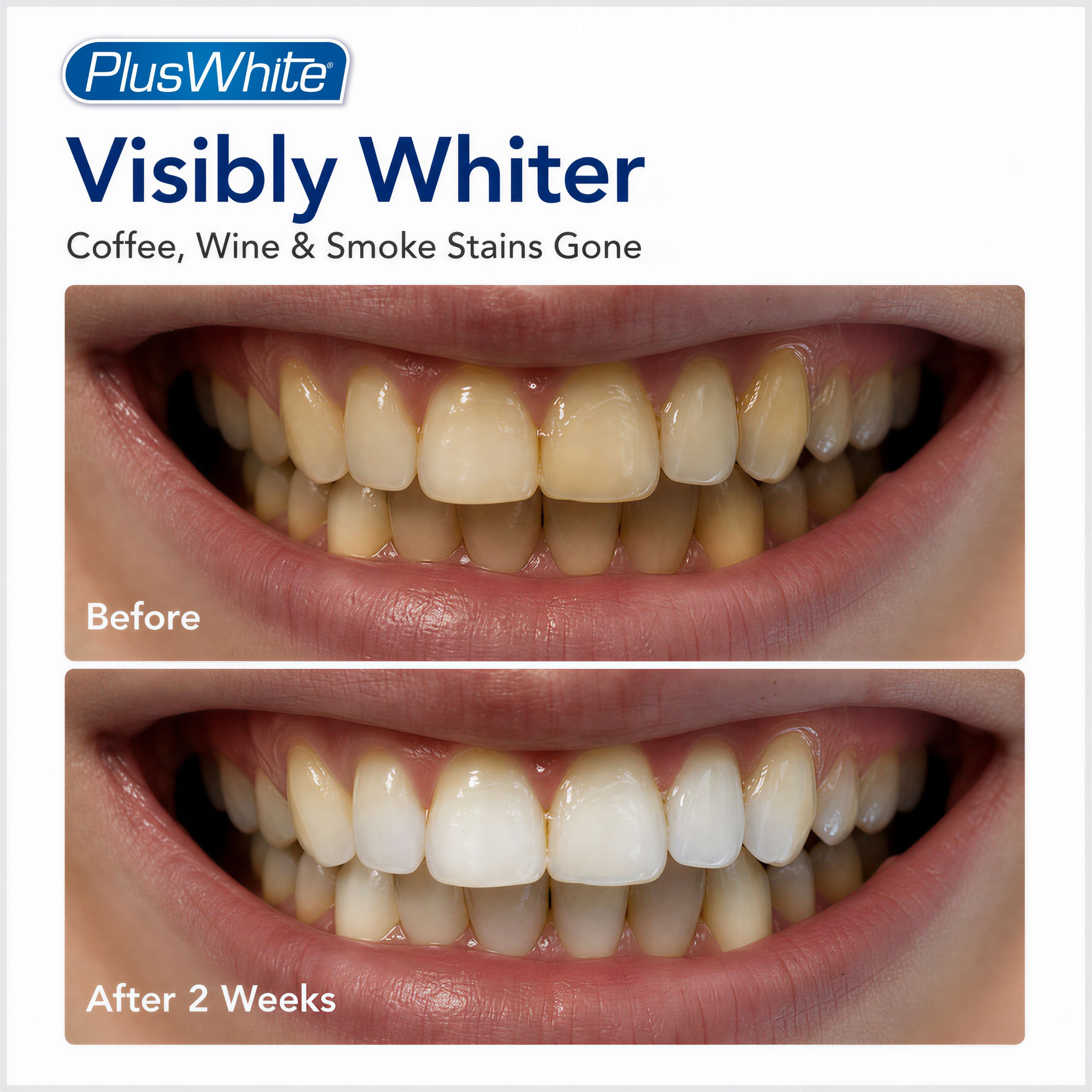 Plus White Speed Whitening Gel, 2 oz photo 3