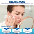 thumbnail image 3 of Crema para el acné AOBBIY Ácido azelaico 12% con alivio del enrojecimiento 30 ml, 3 of 8