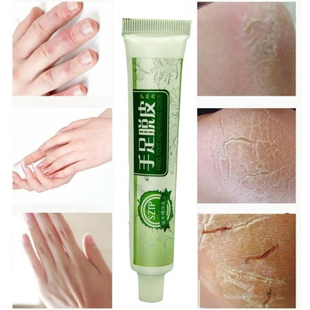 Cracked Heel Balm Cream For Rough Dry & Cracked Chapped Feet Heel (Best Foot Cream For Cracked Skin)