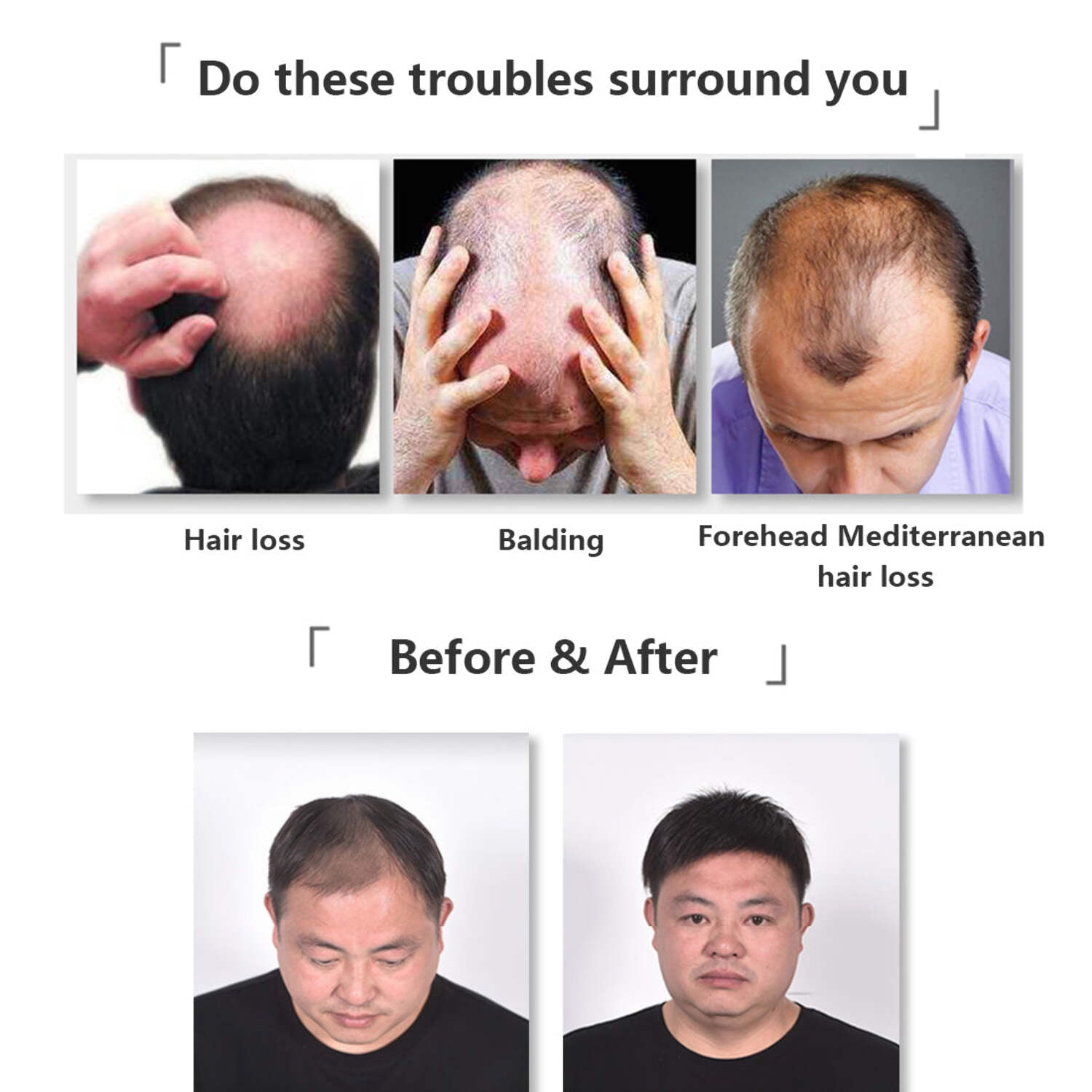 No trimming Hand Tied Lace Toupee Human Hair Extension Clip in Hairpieces Topper Top Hair Piece for Men with Hair Loss Natural Black